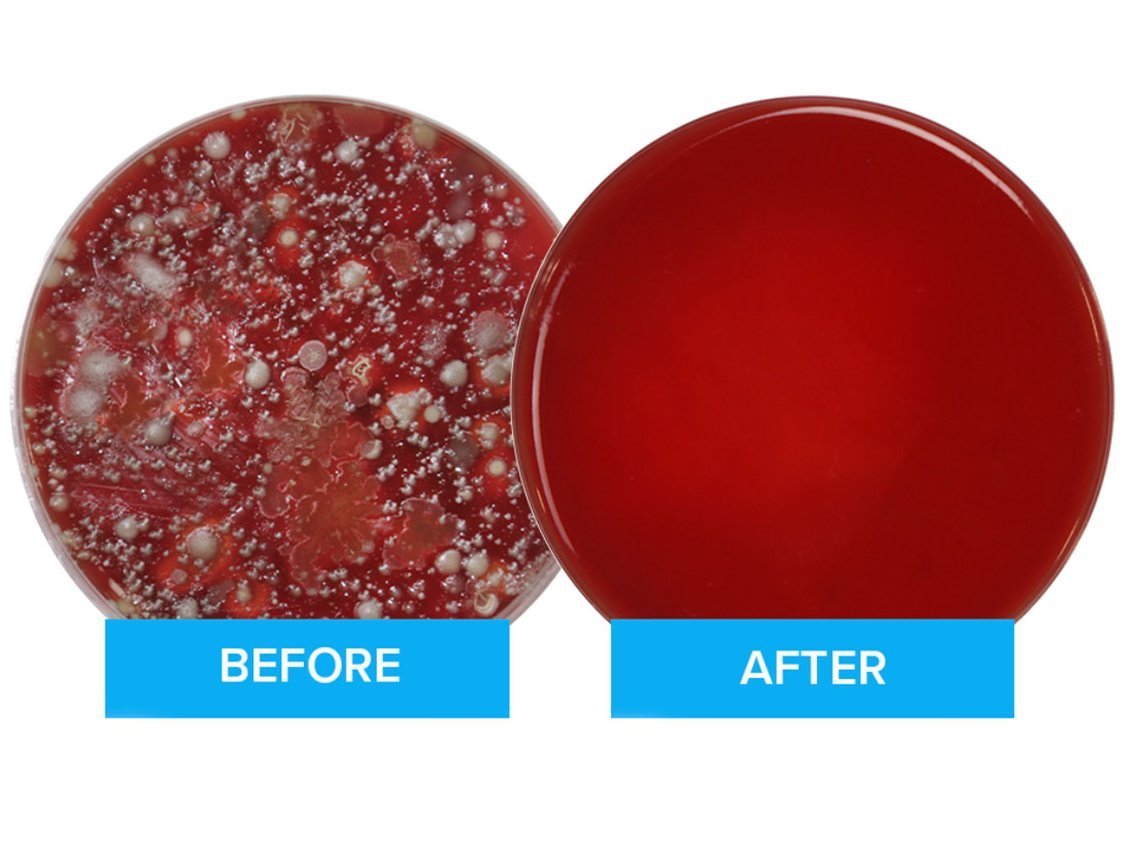 便器の18倍の菌